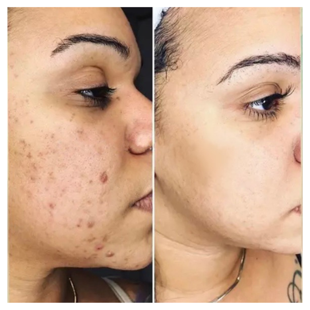 Supreme Even Essence