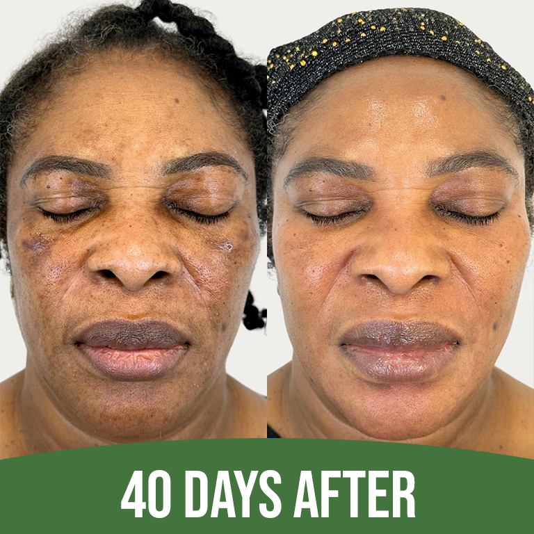 Supreme Even Essence