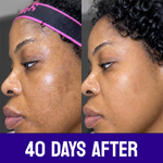 Pro Advance Extreme Glow Face Cream (Potent)