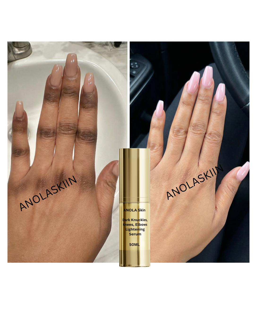 Dark Knuckles, Knees, Elbows, & Feet Lightening Serum