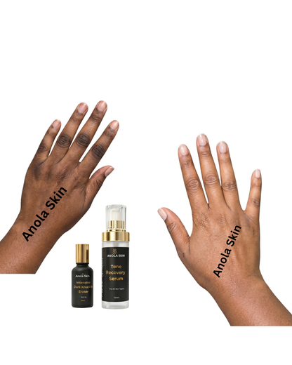 Dark Knuckle Treatment (Results Driven )