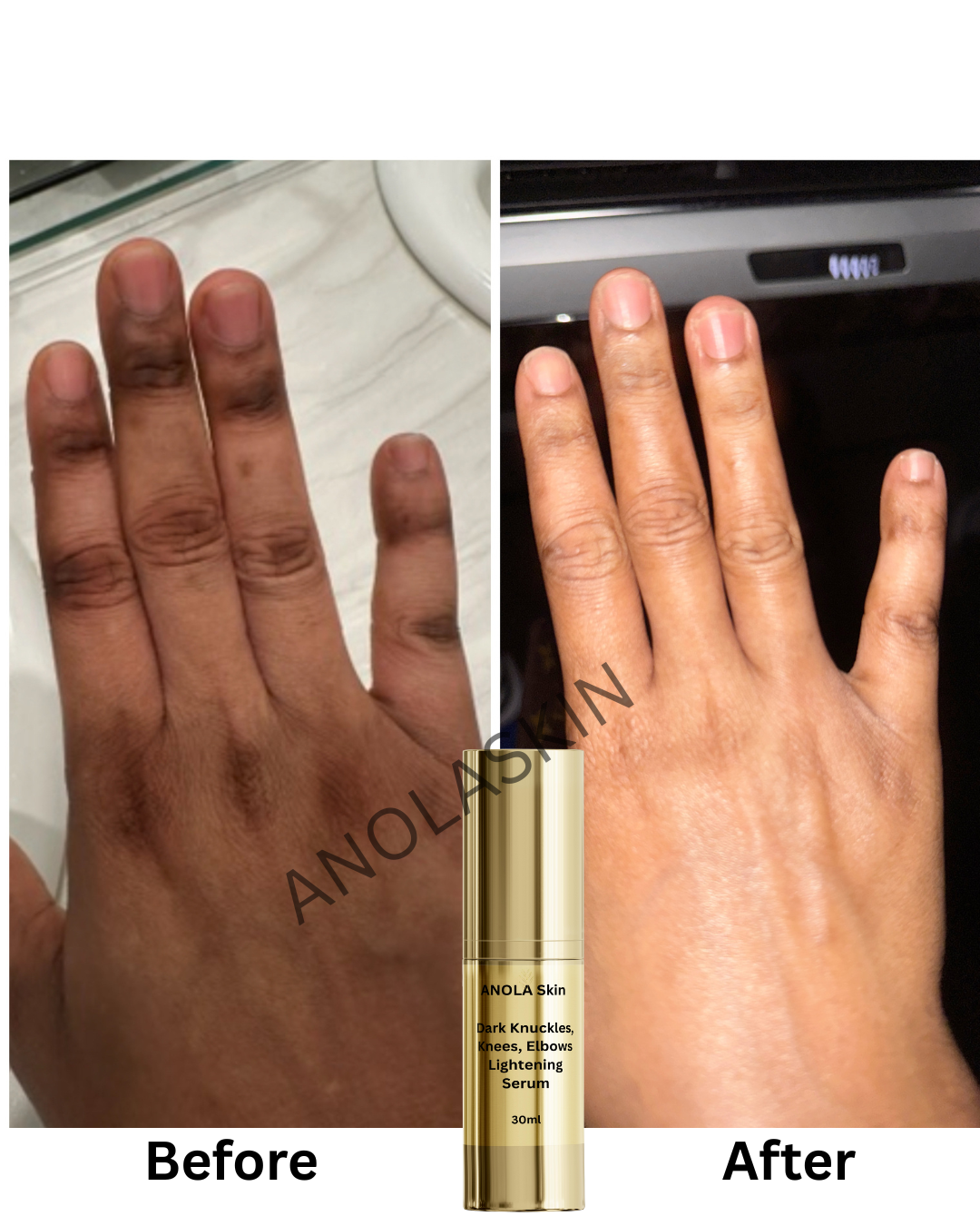 Dark Knuckles, Knees, Elbows, & Feet Lightening Serum