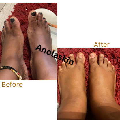 Dark Knuckles, Knees, Elbows, & Feet Lightening Serum