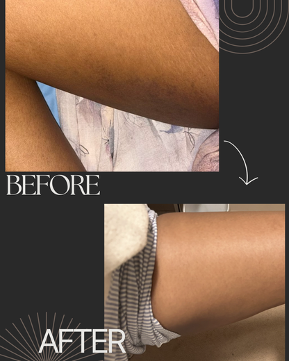 Pro-Advance Lightening Body Lotion