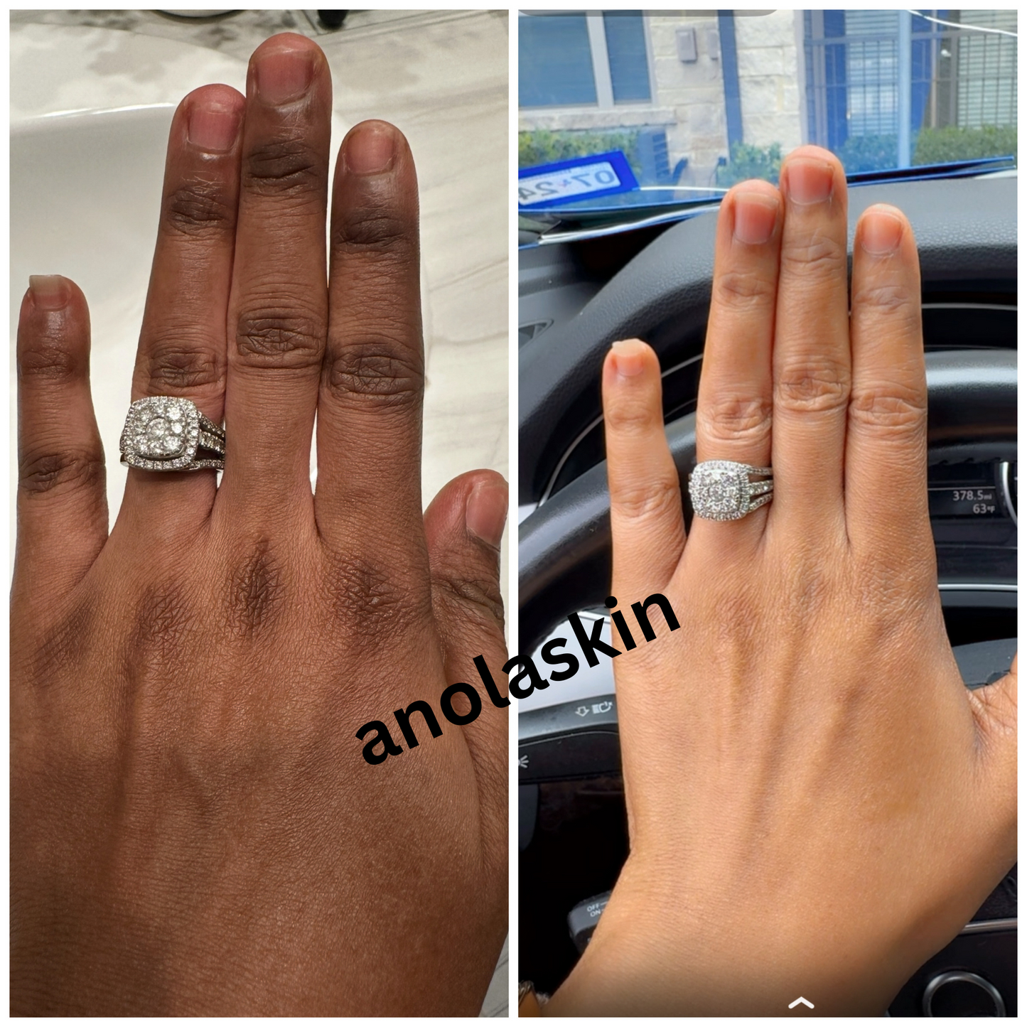 Dark Knuckles, Knees, Elbows, & Feet Lightening Serum