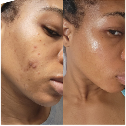 Revive Lightening Cream