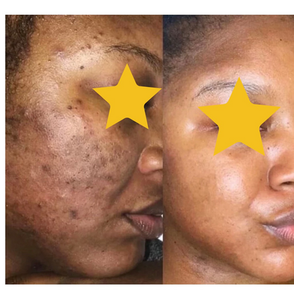 Revive Lightening Cream